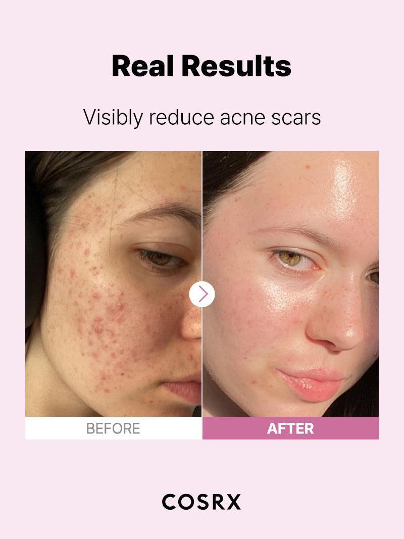 The Niacinamide 15 Serum